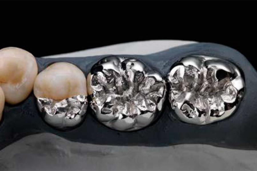 Z Crown Dental Ceramill® Sintron Image